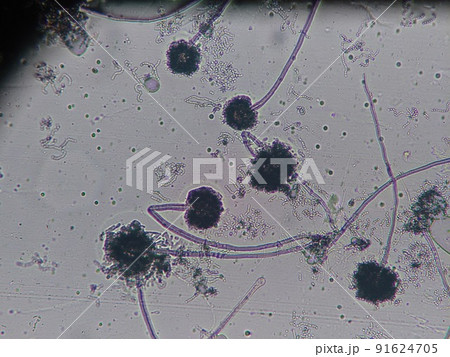 白い胞子のカビを顕微鏡で観察したら黒かった 白い胞子のカビを顕微鏡で観察したら黒かった 91624705