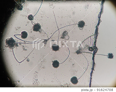 ケカビの胞子の顕微鏡観察 ケカビの胞子の顕微鏡観察 91624708