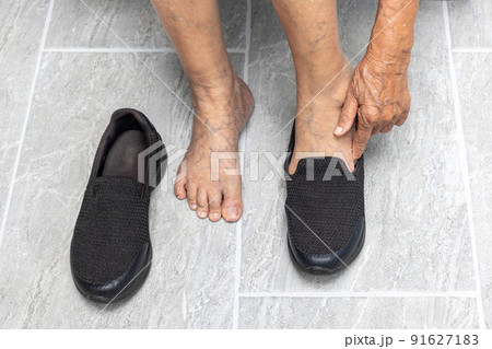 Elderly woman varicose veins feet puts on a shoes at home. Elderly woman varicose veins feet puts on a shoes at home. 91627183