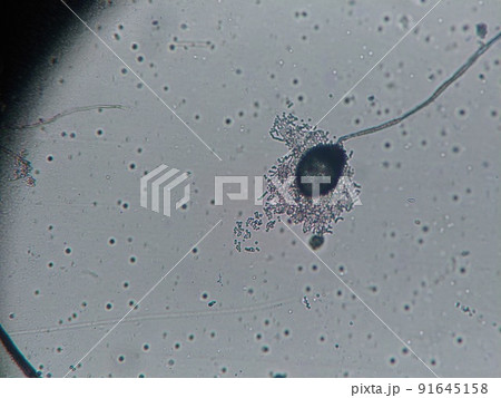 ムコール状のカビ ムコール状のカビ 91645158