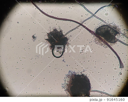 胞子が大きいサイズのカビ 91645160