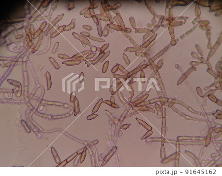 少し先のとがった胞子の様子 少し先のとがった胞子の様子 91645162