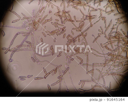 胞子を大量に放出している様子 胞子を大量に放出している様子 91645164