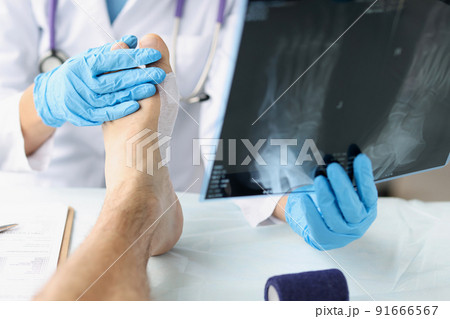 Traumatologist looking at xray of foot and examining patient Traumatologist looking at xray of foot and examining patient 91666567
