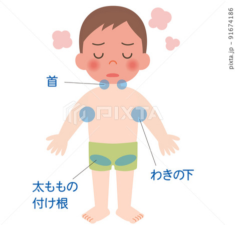熱中症の時の冷却部位（子ども） 91674186