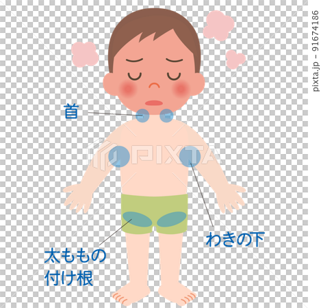 熱中症の時の冷却部位（子ども） 91674186