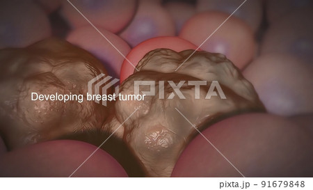 Cancer begins when genetic changes interfere with this orderly process. 91679848