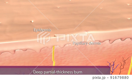Epidermis of thin skin. From the depth to the surface it can be identified the the basale, spinosum, granulosum and corneum strata. 91679880