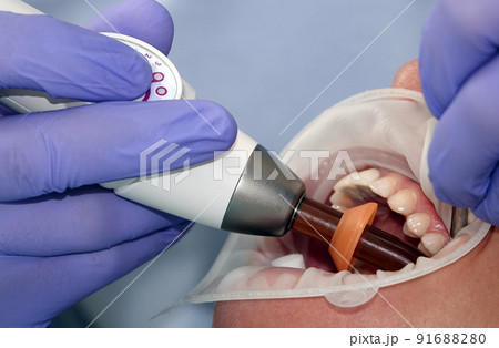 Doctor dentist working with a patient Doctor dentist working with a patient 91688280