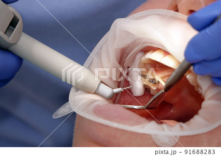Doctor dentist working with a patient Doctor dentist working with a patient 91688283