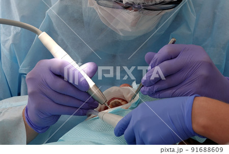 doctor dentist working with a patient shot close-up 91688609