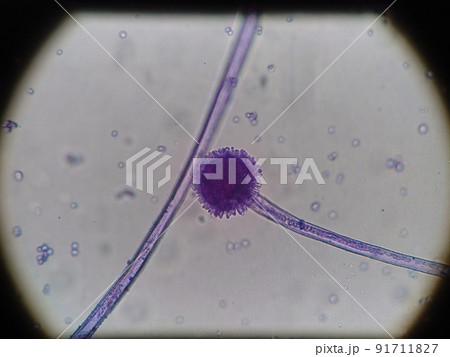 染色したクモノスカビの胞子 染色したクモノスカビの胞子 91711827