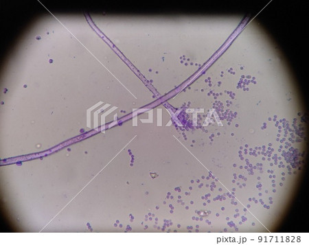 胞子の放出 胞子の放出 91711828