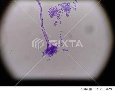 クモノスカビの顕微鏡写真 クモノスカビの顕微鏡写真 91711829