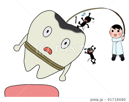 抜歯（男性医師・虫歯・バイ菌） 91716080