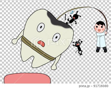 抜歯（男性医師・虫歯・バイ菌） 91716080