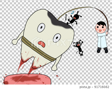 抜歯（男性医師・血・虫歯・バイ菌） 91716082