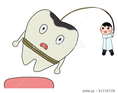 抜歯(男性医師・虫歯) 抜歯(男性医師・虫歯) 91716726