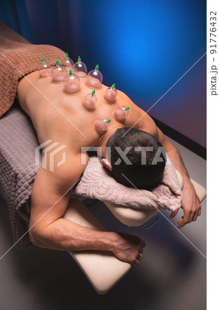 Vertical shot Relaxed young muscular man getting cupping treatment on his back lying on table 91776432