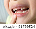 歯が抜けた日本人の子供 91799524