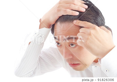 おでこの生え際を気にする中年男性 おでこの生え際を気にする中年男性 91826306