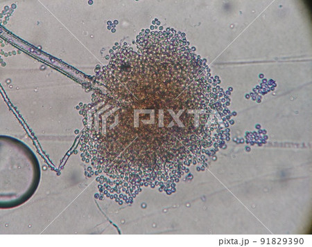 カビの胞子の顕微鏡写真拡大 カビの胞子の顕微鏡写真拡大 91829390