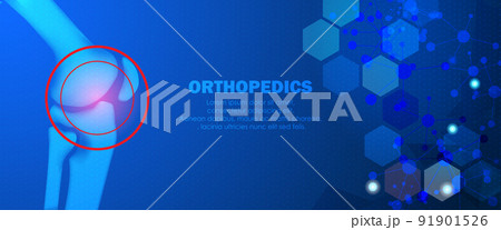 Technology for treatment of knee bone. Abstract traumatology and orthopedics. Medical science in the hospital for body joints. Technology for treatment of knee bone. Abstract traumatology and orthopedics. Medical science in the hospital for body joints. 91901526