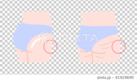 緊實臀部和下垂臀部的插圖集 91929690