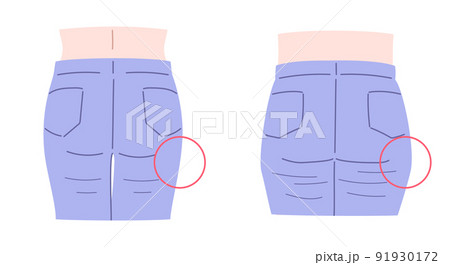 上がったお尻と垂れたお尻のイラストセット 91930172