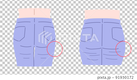 上がったお尻と垂れたお尻のイラストセット 91930172