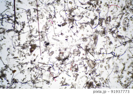 顕微鏡で拡大したハウスダストとダニ 顕微鏡で拡大したハウスダストとダニ 91937773