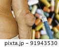 Severe gout in men suffering from joint pain, bone pain, gout, rheumatoid symptoms, radioactive sickness, ill man concept of male osteoporosis, injured bone, injury, pain, arthritis,arm, foot, knee 91943530