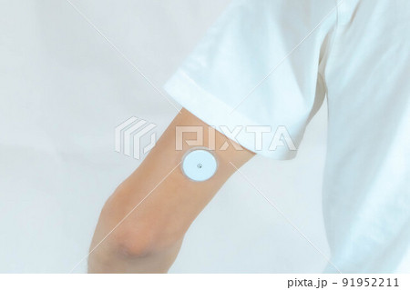 血糖グルコースモニタリング用のセンサーを二の腕裏に装着した男性 91952211