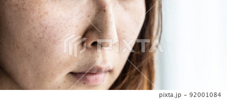 スッピンのミドル女性(美容・肌・シミ・肝斑) スッピンのミドル女性(美容・肌・シミ・肝斑) 92001084