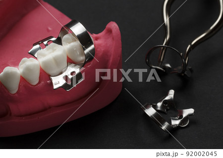 Layout of the human jaw with dam clamps. 92002045