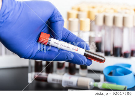 Doctor's hands hold blood samples of the new variant IHU, covid19, coronavirus. Selective approach to the sample tube. 92017506
