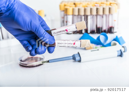 Doctor's hands hold blood samples of the new variant omicron plus flu FLUORONA, covid19, coronavirus. Selective approach to the sample tube. Doctor's hands hold blood samples of the new variant omicron plus flu FLUORONA, covid19, coronavirus. Selective approach to the sample tube. 92017517