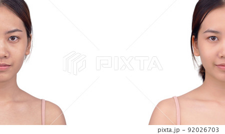 Comparison face of beautiful Asian young woman before and after make up. Development of skin repairing and retouching concept. Comparison face of beautiful Asian young woman before and after make up. Development of skin repairing and retouching concept. 92026703