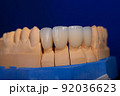 Frames of ceramic crowns on a gypsum model. Zirconia crowns. Metal-free ceramics at the manufacturing stage. Close-up, black isolate. 92036623