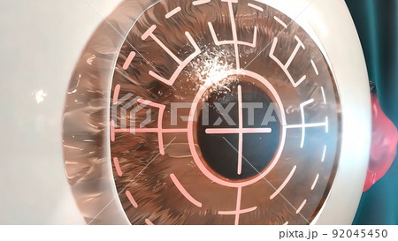 Surgical operations on the human eye Surgical operations on the human eye 92045450
