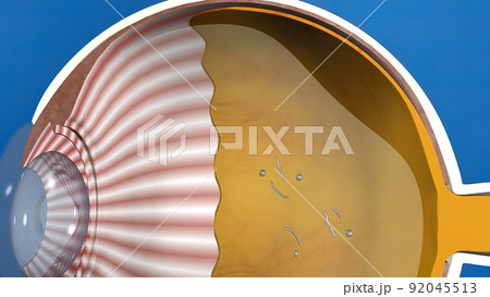 3D illustration medical animated eye anatomy, eye stain formation 92045513