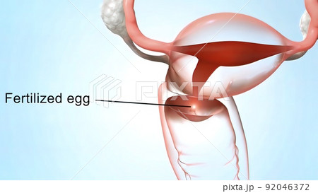 Fertilization happens when a sperm cell successfully meets an egg cell in the fallopian tube. 92046372
