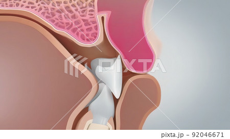 If the gums recede too much, it can cause bone loss that can cause teeth to loosen or fall out. 92046671