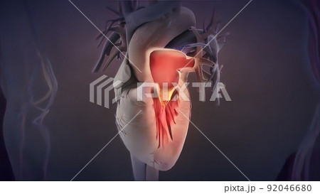 heart valve inflammation 3d medical 92046680
