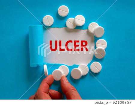 Stomach ulcer symbol. The word 'ulcer' appearing behind torn blue paper, white pills. Doctor hand. Medical and stomach ulcer concept. Copy space. 92109357