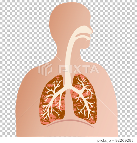 Colorful lung and bronchial illustrations and silhouettes of people with watercolor textures Colorful lung and bronchial illustrations and silhouettes of people with watercolor textures 92209295