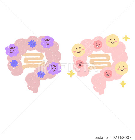 善玉菌のいる腸と悪玉菌のいる腸 92368007