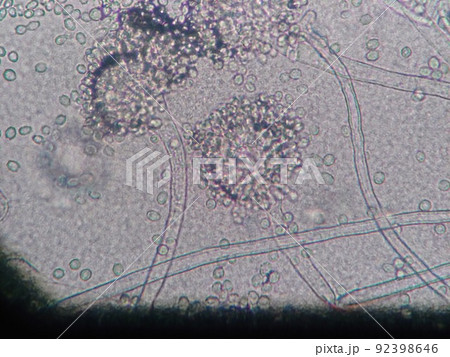 ケカビの顕微鏡写真 92398646