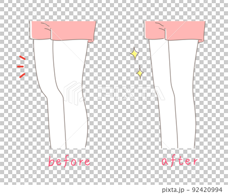 太ももが太い女性と細い女性のイラスト素材 太ももが太い女性と細い女性のイラスト素材 92420994