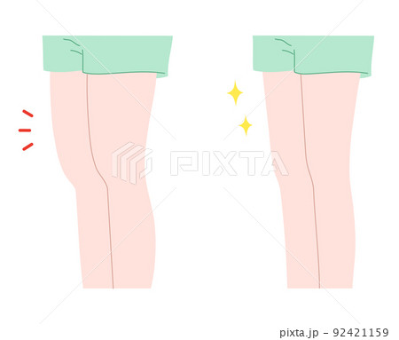 太ももが太い女性と細い女性のイラスト素材のイラスト素材